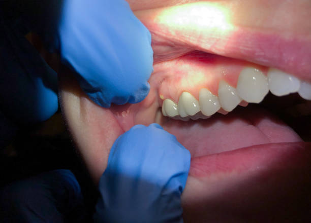 Best Emergency Dental Services for Seniors in Shackle Island, TN
