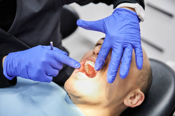 Best Emergency Dentist for Lost Fillings or Crowns in Shackle Island, TN
