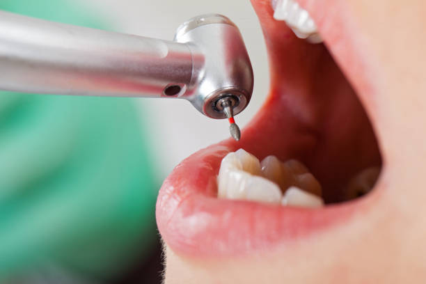 Best Emergency Dentist for Knocked-Out Tooth in Shackle Island, TN